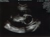 Baby #2 Profile.jpg