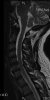 LisaLateralMRI.jpg